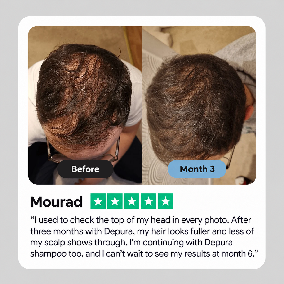 Depura® Hair Regenerating Serum